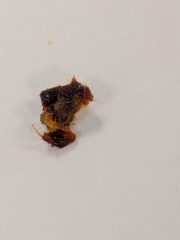 Ear wax glory