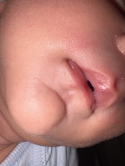 Do these spots look like a cold sore in a child?