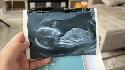 Nub theory - gender confirmed!