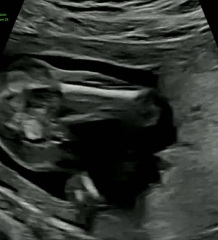17 week potty shots. Confused. Please help!