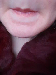 What's this weird rash on my face I've had for years?