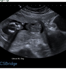 Any guesses on my baby's sex before I find out?