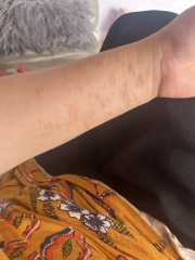 Weird rash and bumps