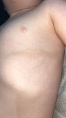 Could this mark on my toddler be a bruise or something else?