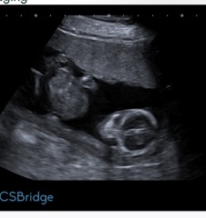 Any guesses on my baby's sex before I find out?