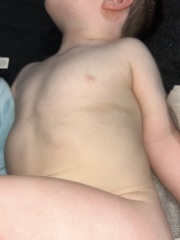Could this mark on my toddler be a bruise or something else?
