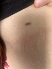 Mole
