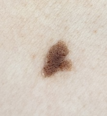 Mole help