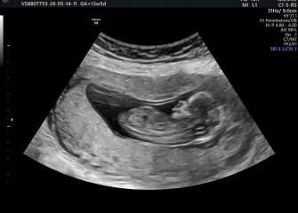 Pregnant with my third, any guesses on baby's sex tomorrow?