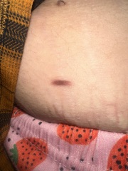 Mole