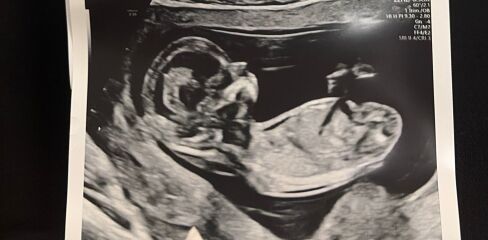 Baby gender guesses