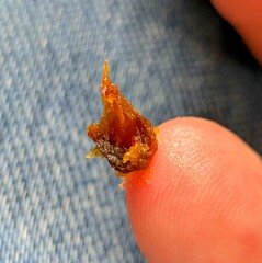 Sporner corner: can I share this ear wax surprise?