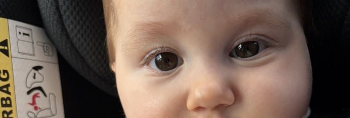 Should I be worried about my 8 month old's eyebrows?