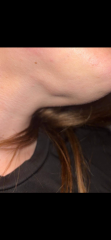 Mole help