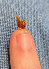 Sporner corner: can I share this ear wax surprise?