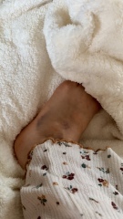 Lump and pain after ridiculous foot injury - need X-ray opinions!