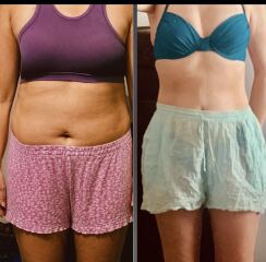 Who wants to share there Mounjaro before and after, I’ll go first.
