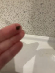 omg I’ve just woken up in a hotel as I felt something crawling on me, it was a bloody bed bug