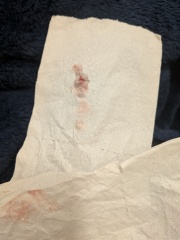 7dpo implantation bleeding or start of AF