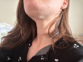 Mole help