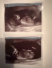 13 weeks 5 days scan, any nub theory guesses?