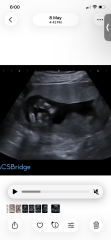 Still nauseous at 18 weeks and wondering about nub theory