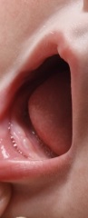 is this teething???