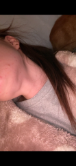 Mole help