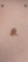 Mole help