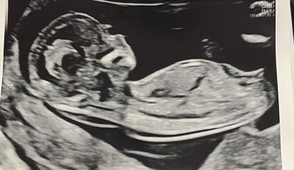 Baby gender guesses
