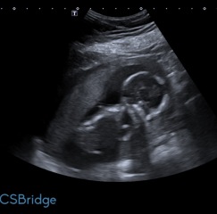 Any guesses on my baby's sex before I find out?