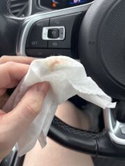 Praying this is implantation bleeding? [pics included]