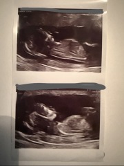 13 weeks 5 days scan, any nub theory guesses?