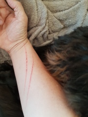 What to do about local aggressive cat.
