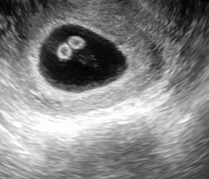 Confused by scans