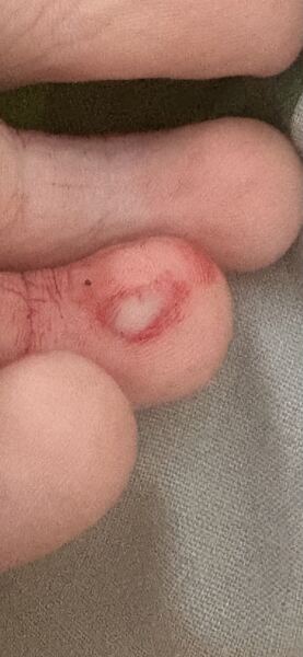 Minor cut! With pic