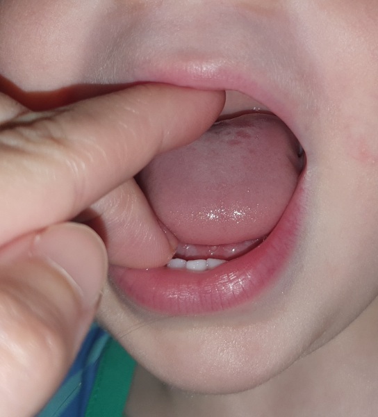 Is this a normal tongue???