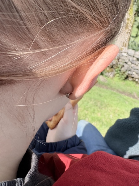 Big lump behind child’s ear