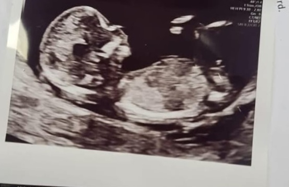 Gender scan tomorrow, any guesses before we find out?