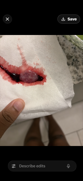 I think I may have had a miscarriage but am unsure [GRAPHIC PHOTOS ATTACHED]