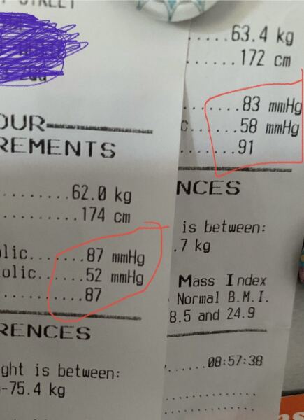 Low blood pressure