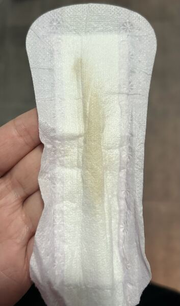 **TMI pic warning** is this normal discharge?