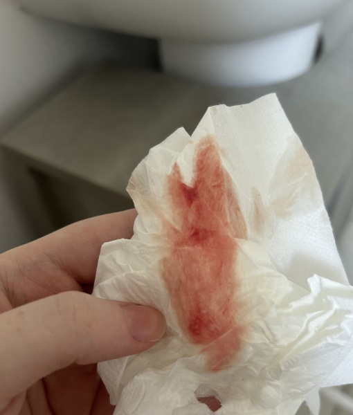 Bleeding in early pregnancy after miscarriage, looking for similar experiences