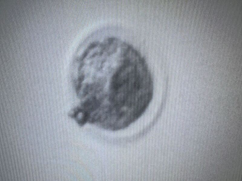 June IVF/FET 👶 🌟 ❤️