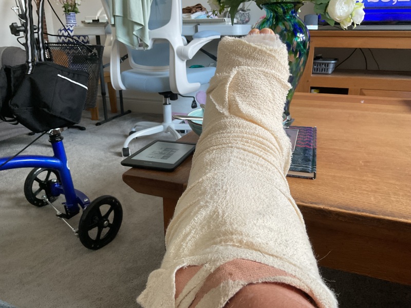 Will i lose my leg