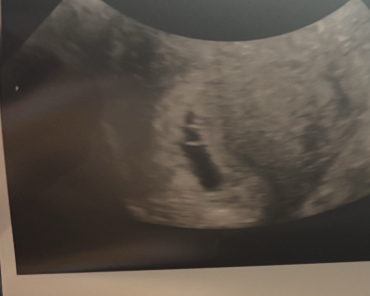 5 week scan