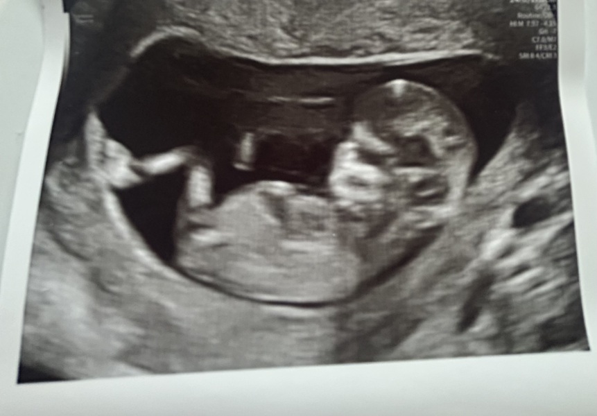 Girl or boy ?