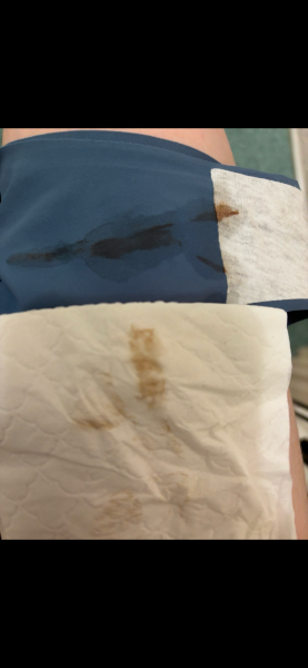 5 weeks with spotting and cramping