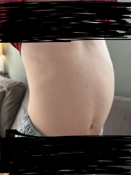 Red itchy rash on son