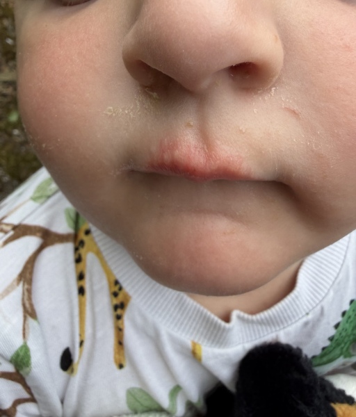 Any ideas what this is on my son’s face…